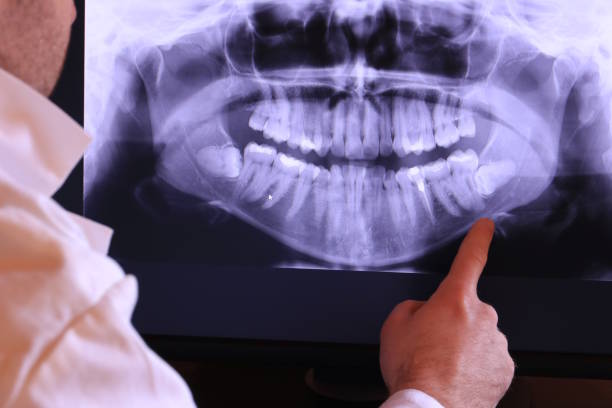 Best Emergency Tooth Extraction in Arbury Hls, IL
